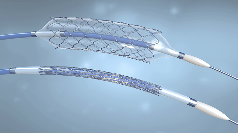 Stent Manufacturing
